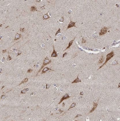 Immunohistochemistry-Paraffin TM9SF4 Antibody - BSA Free