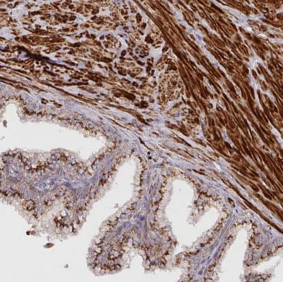 Immunohistochemistry-Paraffin: TM9SF4 Antibody [NBP2-32382] -Staining of human prostate shows strong cytoplasmic granular positivity in smooth muscle cells and glandular cells.