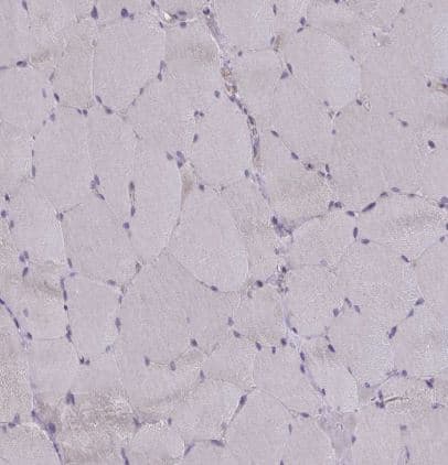 Immunohistochemistry-Paraffin: Wnt-9b Antibody [NBP2-32479] - Staining of human skeletal muscle shows no positivity in myocytes as expected.