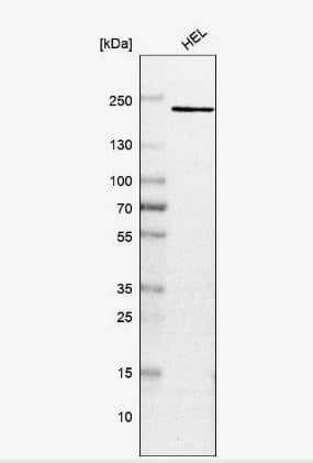 Western Blot: PSME4 Antibody [NBP2-32575] - Analysis in human cell line HEL.