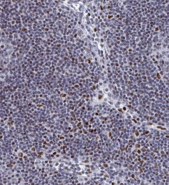 Immunohistochemistry-Paraffin C15orf41 Antibody - BSA Free
