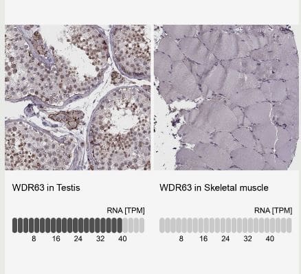 Immunohistochemistry-Paraffin WDR63 Antibody - BSA Free