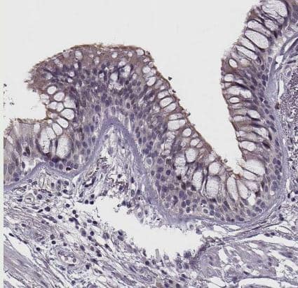 Immunohistochemistry-Paraffin WDR63 Antibody - BSA Free