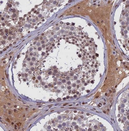 Immunohistochemistry-Paraffin: CDC7 Antibody [NBP2-32708] -Staining of human testis shows moderate nuclear positivity in cells in seminiferous ducts.