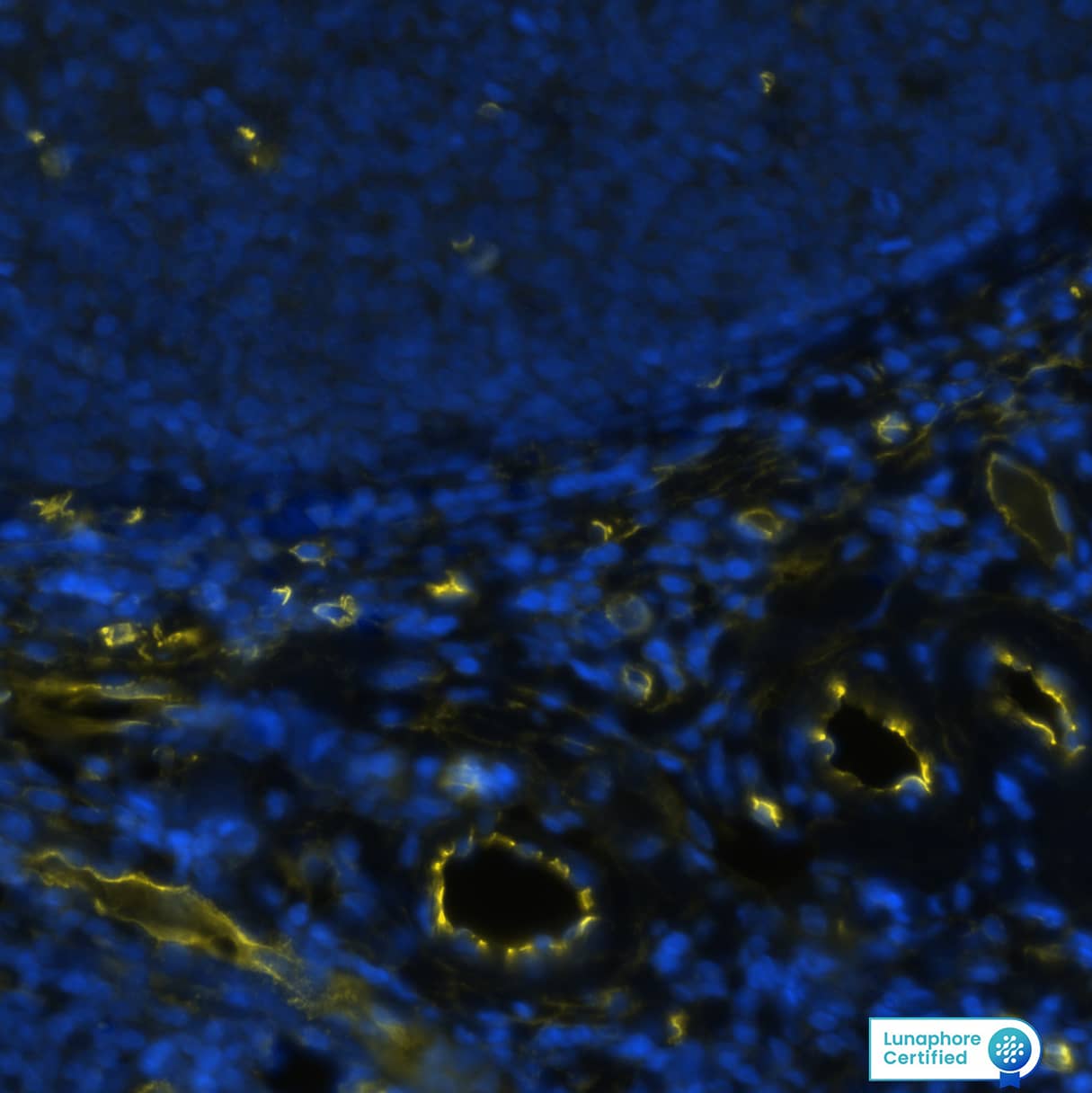 CD34 was detected in immersion fixed paraffin-embedded sections of human tonsil using Mouse Anti-Human CD34 Monoclonal Antibody (Novus Catalog # NBP2-32932) at 10 µg/mL at 37 ° Celsius for 4 minutes. Before incubation with the primary antibody, tissue underwent an all-in-one dewaxing and antigen retrieval preprocessing using PreTreatment Module (PT Module) and Dewax and HIER Buffer H (pH 9; Epredia Catalog # TA-999-DHBH). Tissue was stained using the Alexa Fluor™ 647 Goat anti-Mouse IgG Secondary Antibody at 1:200 at 37 ° Celsius for 2 minutes. (Yellow; Lunaphore Catalog # DR647MS) and counterstained with DAPI (blue; Lunaphore Catalog # DR100). Specific staining was localized to the cell membrane. Protocol available in COMET™ Panel Builder.