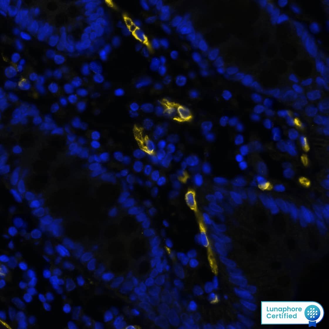 CD34 was detected in immersion fixed paraffin-embedded sections of human colon using Mouse Anti-Human CD34 Monoclonal Antibody (Novus Catalog # NBP2-32932) at 10 µg/mL at 37 ° Celsius for 4 minutes. Before incubation with the primary antibody, tissue underwent an all-in-one dewaxing and antigen retrieval preprocessing using PreTreatment Module (PT Module) and Dewax and HIER Buffer H (pH 9; Epredia Catalog # TA-999-DHBH). Tissue was stained using the Alexa Fluor™ 647 Goat anti-Mouse IgG Secondary Antibody at 1:200 at 37 ° Celsius for 2 minutes. (Yellow; Lunaphore Catalog # DR647MS) and counterstained with DAPI (blue; Lunaphore Catalog # DR100). Specific staining was localized to the cell membrane. Protocol available in COMET™ Panel Builder.