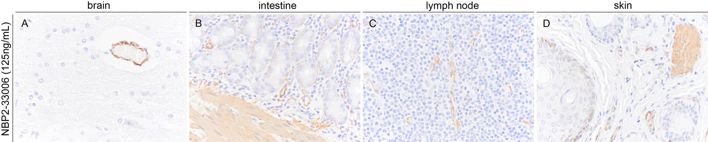 Immunohistochemistry-Paraffin: Mouse Monoclonal alpha-Smooth Muscle Actin Antibody (1A4/asm-1) [NBP2-33006] - Images demonstrating SMA immunoreactivity in a variety of horse FFPE tissue sections. NBP2-33006 was used at a concentration of 125ng/mL and was left on tissue sections for 30m at room temperature. Formalin fixed paraffin embedded sections were deparaffinized and rehydrated. Sections then underwent heat induced epitope retrieval in a citrate-based solution for 5min in a food steamer. Endogenous peroxidase activity was blocked by incubating slides for 15min in tris buffered saline containing 3% (volume/volume) hydrogen peroxide. Tissue sections were then washed, blocked with normal horse serum for 20 min, and then incubated with the primary antibody (125ng/mL) for 30min at room temperature. Sections were then washed and incubated with a horse anti-mouse HRP polymer for 30m at room temperature. Sections were washed and incubated with DAB chromogen for approximately 2.5min. Sections were then washed, counterstained with hematoxylin, dehydrated, cleared and mounted with a coverslip. Image from a verified customer review.
