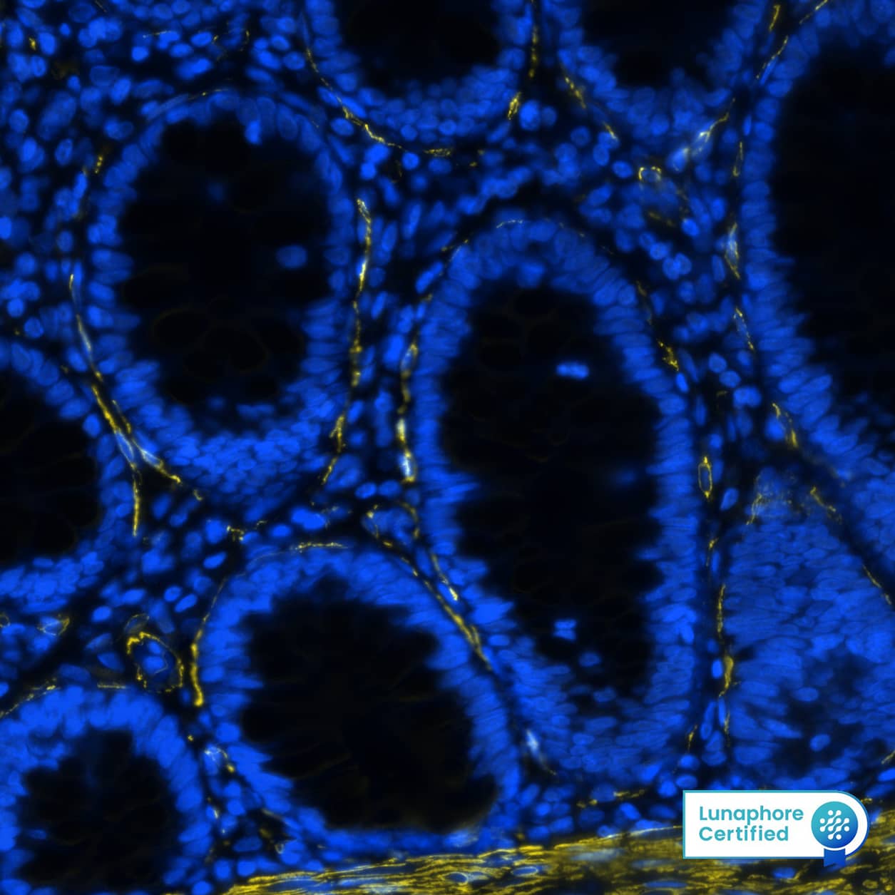  alpha -Smooth Muscle Actin was detected in immersion fixed paraffin-embedded sections of human colon using Mouse Anti-Human/Mouse/Rat  alpha -Smooth Muscle Actin Monoclonal Antibody (Novus Catalog # NBP2-33006) at 0.25ug/mL at 37 ° Celsius for 2 minutes. Before incubation with the primary antibody, tissue underwent an all-in-one dewaxing and antigen retrieval preprocessing using PreTreatment Module (PT Module) and Dewax and HIER Buffer H (pH 9). Tissue was stained using the Alexa Fluor™ 555 Goat anti-Mouse IgG Secondary Antibody at 1:100 at 37 ° Celsius for 2 minutes. (Yellow; Lunaphore Catalog # DR555MS) and counterstained with DAPI (blue; Lunaphore Catalog # DR100). Specific staining was localized to the cytoplasm and cytoskeleton. Protocol available in COMET™ Panel Builder.