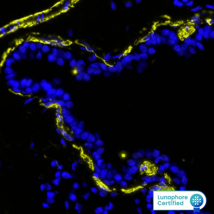 SMA Antibody was detected in immersion fixed paraffin-embedded sections of mouse Lung using Mouse Anti-Human/Mouse SMA, Monoclonal Antibody (Catalog #NBP2-33006) at 0.25ug/mL at 37 ° Celsius for 2 minutes. Before incubation with the primary antibody, tissue underwent an all-in-one dewaxing and antigen retrieval preprocessing using PreTreatment Module (PT Module) and Dewax and HIER Buffer H (pH 9; Epredia Catalog # TA-999-DHBH). Tissue was stained using the Alexa Fluor™ 555 Goat anti-Mouse IgG Secondary Antibody at 1:100 at 37 ° Celsius for 2 minutes. (Yellow; Lunaphore Catalog # DR555MS) and counterstained with DAPI (blue; Lunaphore Catalog # DR100). Specific staining was localized to the cytoplasm. Protocol available in COMET™ Panel Builder.