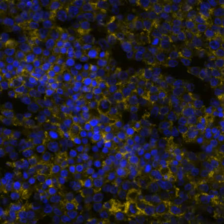 B7-1/CD80 was detected in immersion fixed paraffin-embedded sections of human Hodgkin's Lymphoma using Mouse Anti-Human B7-1/CD80, Monoclonal Antibody  at 20ug/mL at 37°Celsius for 4 minutes. Before incubation with the primary antibody, tissue underwent an all-in-one dewaxing and antigen retrieval preprocessing using PreTreatment Module (PT Module) and Dewax and HIER Buffer H (pH 9; Epredia Catalog # TA-999-DHBH). Tissue was stained using the Alexa Fluor™ 647 Goat anti-Mouse IgG Secondary Antibody at 1:200 at 37 ° Celsius for 2 minutes. (Yellow; Lunaphore Catalog # DR647MS) and counterstained with DAPI (blue; Lunaphore Catalog # DR100). Specific staining was localized to the membrane. Protocol available in COMET™ Panel Builder.