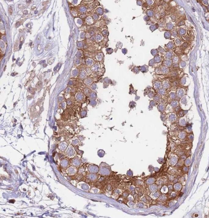 Staining of human testis shows strong cytoplasmic-membranous/nuclear membranous positivity in cells in seminiferous ducts.