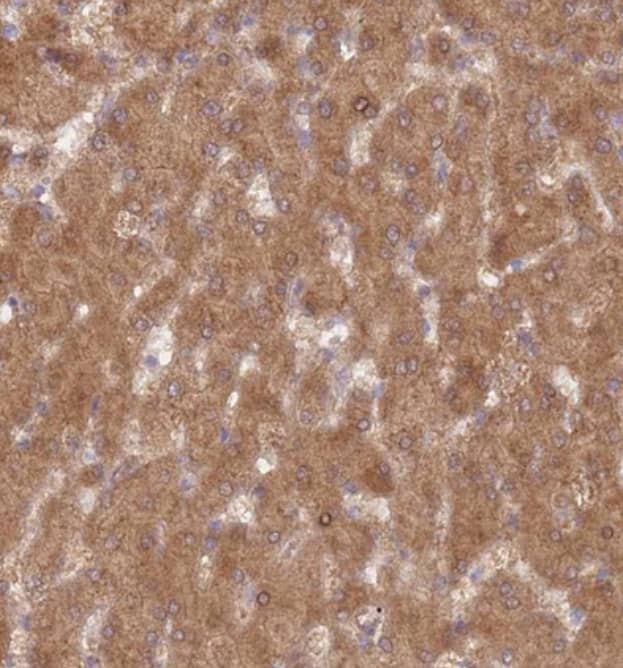 Staining of human liver shows moderate cytoplasmic additional nuclear membranous positivity in hepatocytes.