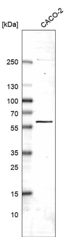 Analysis in human cell line CACO-2.