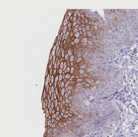 Immunohistochemistry-Paraffin RHBG Antibody