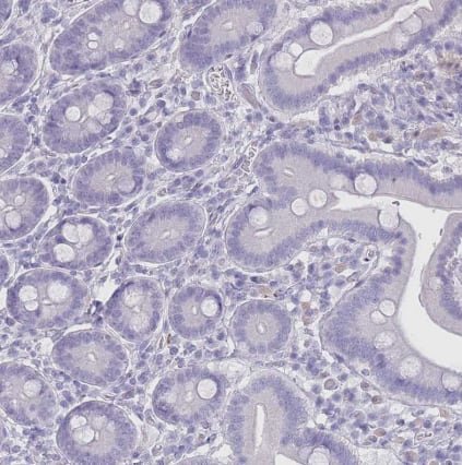 Immunohistochemistry-Paraffin RHBG Antibody