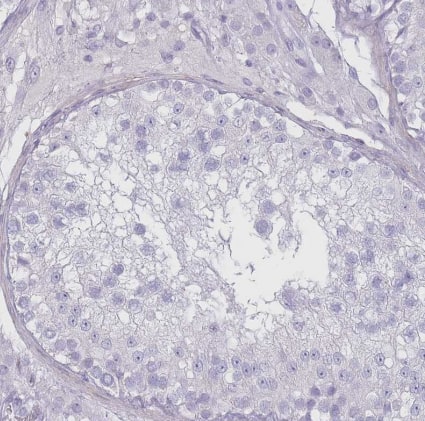 Immunohistochemistry-Paraffin RHBG Antibody