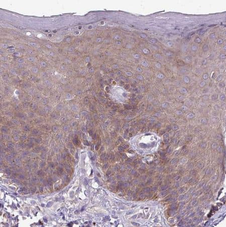 Staining of human skin shows weak cytoplasmic positivity in squamous epithelial cells.