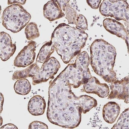 Immunohistochemistry-Paraffin ABHD11 Antibody