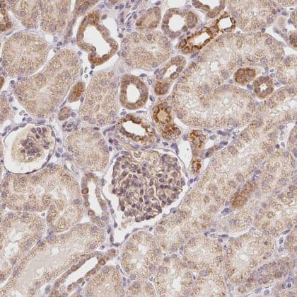 Immunohistochemistry-Paraffin ABHD11 Antibody