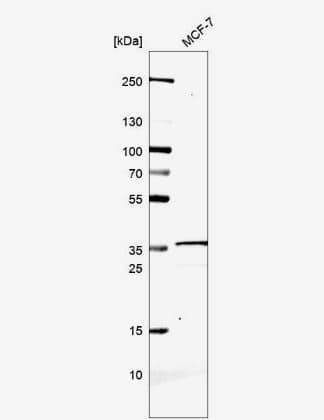 Western Blot ABHD11 Antibody