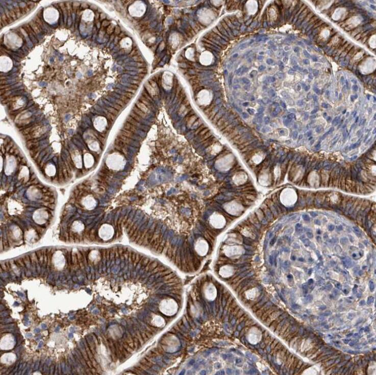 Staining of human small intestine shows strong membranous positivity in glandular cells.