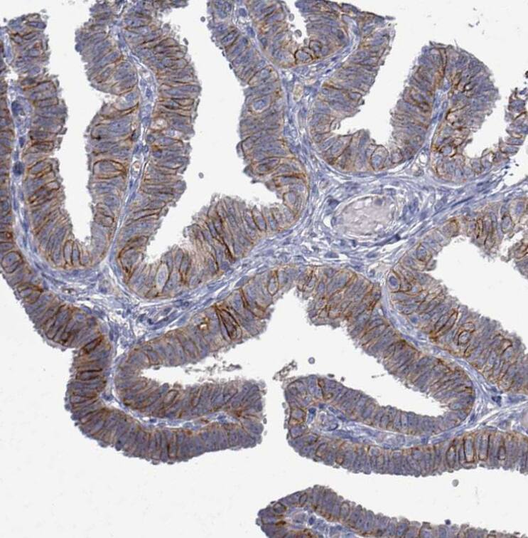  Staining of human fallopian tube shows moderate membranous positivity in glandular cells.