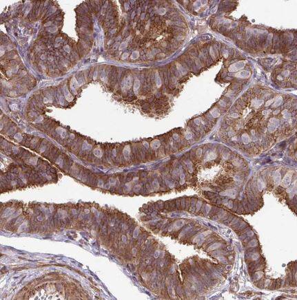 Immunohistochemistry-Paraffin: TRIP6 Antibody [NBP2-33667] -Staining of human fallopian tube shows strong cytoplasmic positivity in glandular cells.