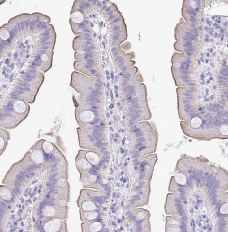 Staining of human small intestine shows moderate membranous positivity in glandular cells.