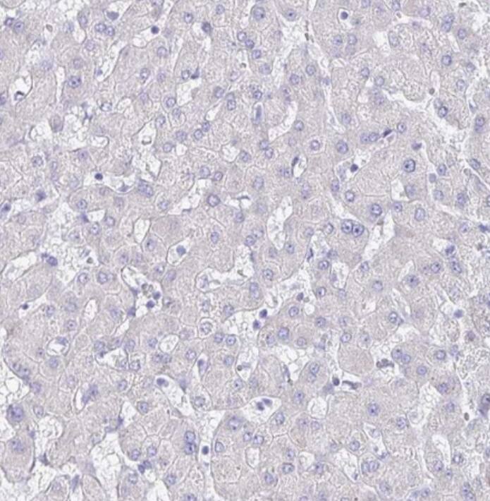 Staining of human liver shows no positivity in hepatocytes as expected.