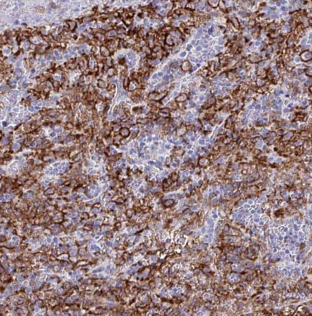 Immunohistochemistry-Paraffin: Fc gamma RIIIA/CD16a Antibody [NBP2-33753] - Staining of human spleen shows strong membranous positivity in cells in red pulp.