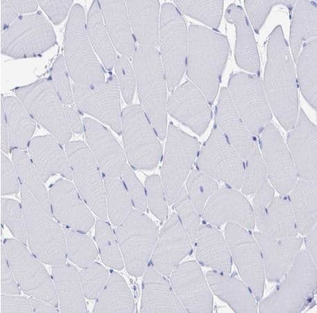 Immunohistochemistry-Paraffin: Fc gamma RIIIA/CD16a Antibody [NBP2-33753] -Staining of human skeletal muscle shows no positivity in myocytes as expected.