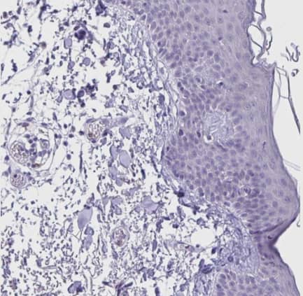 Immunohistochemistry-Paraffin: HOXB4 Antibody [NBP2-33833] -  Staining of human skin shows no positivity in squamous epithelial cells.