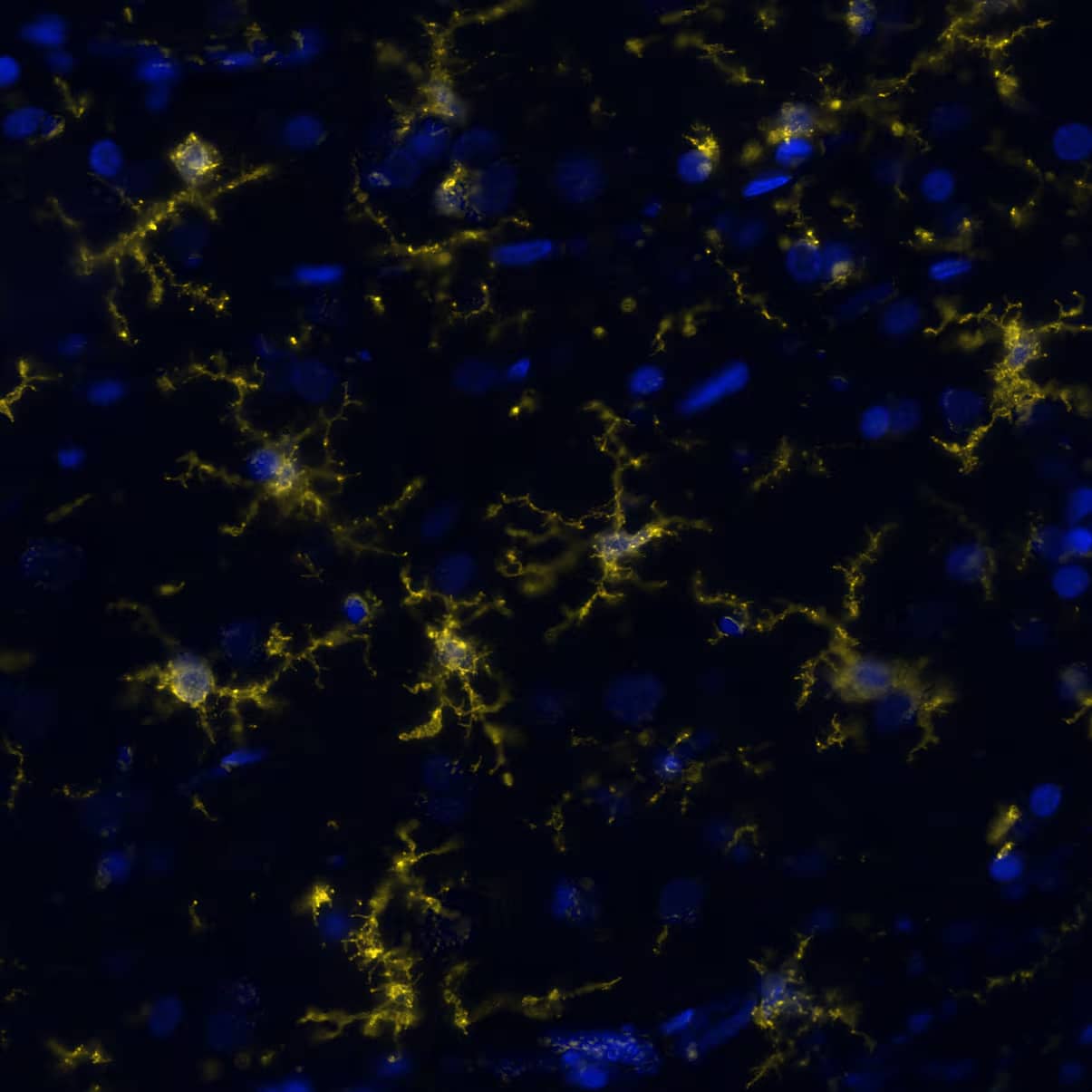 P2Y12/P2RY12 was detected in immersion fixed paraffin-embedded sections of human Cortex using Rabbit Anti-human P2Y12/P2RY12, Polyclonal Antibody (Catalog # NBP2-33870) at 1:100 at 37°Celsius for 4 minutes. Before incubation with the primary antibody, tissue underwent an all-in-one dewaxing and antigen retrieval preprocessing using PreTreatment Module (PT Module) and Dewax and HIER Buffer H (pH 9; Epredia Catalog # TA-999-DHBH).Tissue was stained using the Alexa Fluor™ Plus 555 Goat anti-Rabbit IgG Secondary Antibody at 1:100 at 37 ° Celsius for 2 minutes. (Yellow; Lunaphore Catalog # DR555RB) and counterstained with DAPI (blue; Lunaphore Catalog # DR100). Specific staining was localized to cell membrane of microglia. Protocol available in COMET™ Panel Builder.