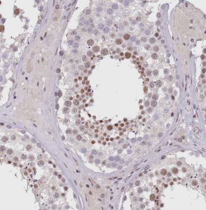 Immunohistochemistry-Paraffin: CIZ1 Antibody [NBP2-33890] - Staining of human testis shows moderate nuclear positivity in spermatids.