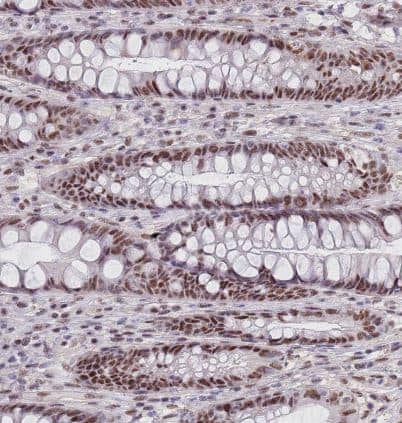 Immunohistochemistry-Paraffin: CIZ1 Antibody [NBP2-33890] - Staining of human rectum shows strong nuclear positivity in glandular cells.