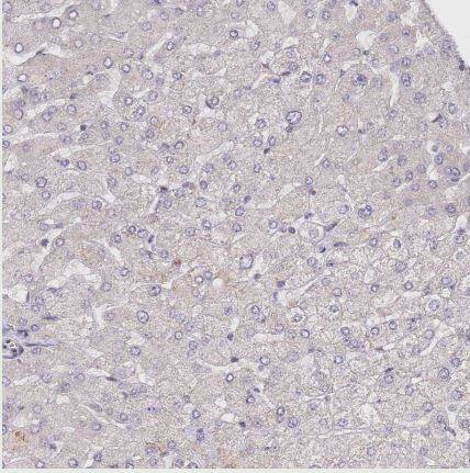 Immunohistochemistry-Paraffin: CIZ1 Antibody [NBP2-33890] -Staining of human liver shows no nuclear positivity in hepatocytes as expected.