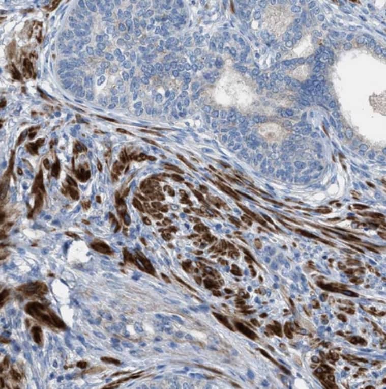 Staining of human prostate shows strong cytoplasmic positivity in smooth muscle cells.
