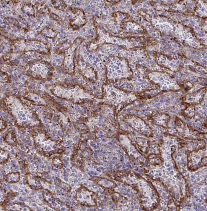 Immunohistochemistry-Paraffin PITPNM3 Antibody