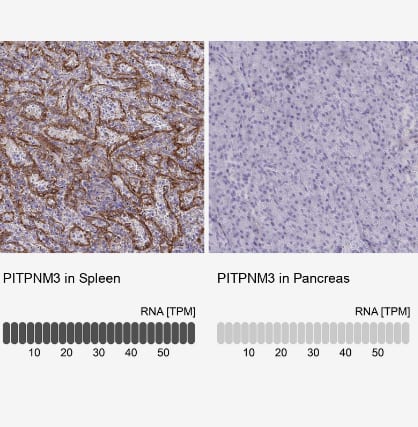 Immunohistochemistry-Paraffin PITPNM3 Antibody