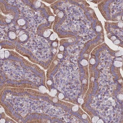 Immunohistochemistry-Paraffin: Pyruvate Dehydrogenase E1-alpha subunit Antibody [NBP2-33922] - Staining of human duodenum shows moderate cytoplasm granular positivity in glandular cells.