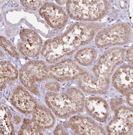 Staining of human kidney shows moderate cytoplasmic positivity in cells in tubules. 