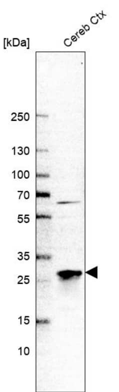 Analysis in human cerebral cortex tissue.