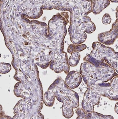 Immunohistochemistry-Paraffin: Pyruvate Dehydrogenase E2 Antibody [NBP2-34065] - Staining of human placenta shows strong cytoplasmic granular positivity in trophoblastic cells.