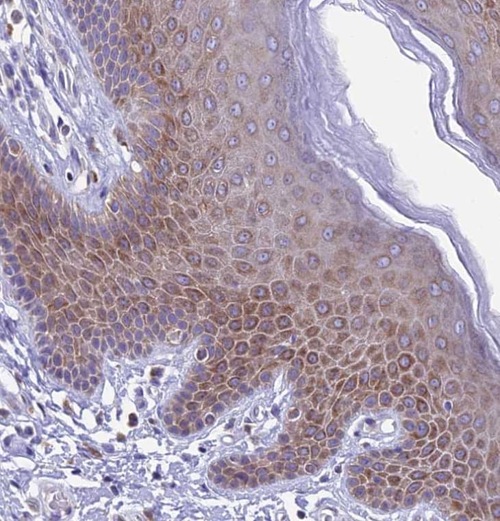 Immunohistochemistry-Paraffin REEP4 Antibody - BSA Free