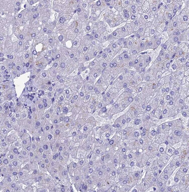 Staining of human liver shows no positivity in hepatocytes.