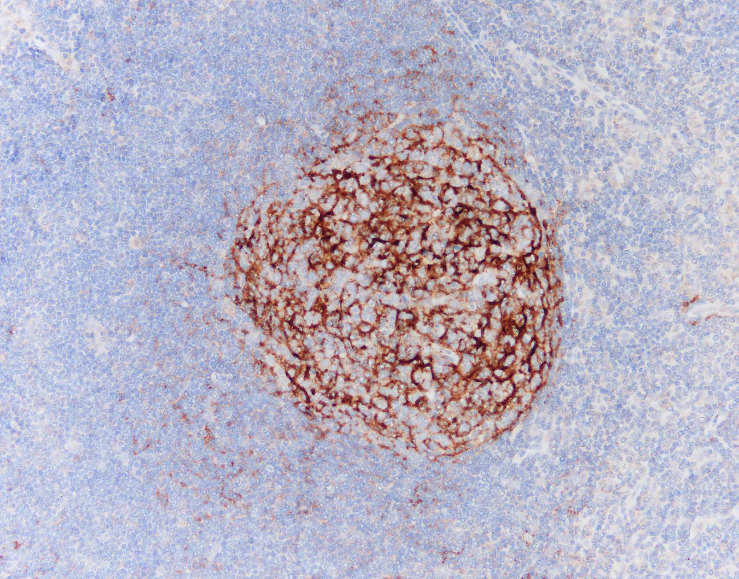 Immunohistochemistry-Paraffin: Mouse Monoclonal Complement C4d Antibody (C4D204) [NBP2-34234] - Analysis of C4d on human lymph node tissue. Follicular dendritic cell are positive for C4d. pAb: 1:200 anti-mouse DAB epitope retrieval in basic buffer. Image from a verified customer review.