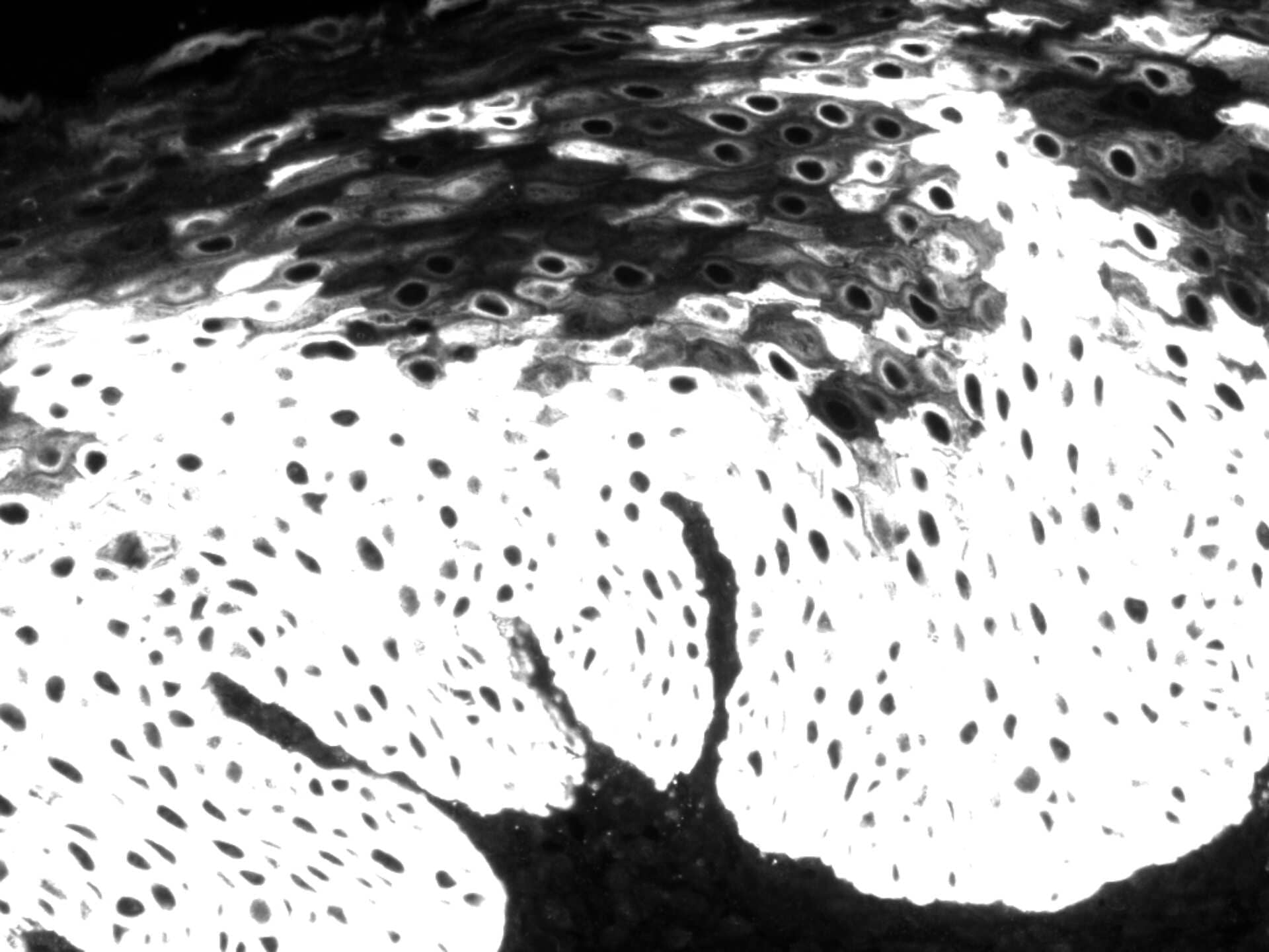 Immunohistochemistry-Paraffin: Cytokeratin 14 Antibody (SPM263) - Human Tonsil tissue with epithelial CK14 expression as monochromatic image. Image from verified customer review.