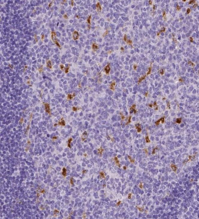 <b>Orthogonal Strategies Validation. </b>Staining of human tonsil shows strong cytoplasmic positivity in germinal center cells.