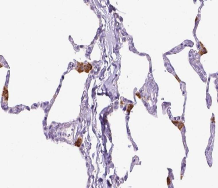  Staining of human lung shows strong cytoplasmic positivity in macrophages.