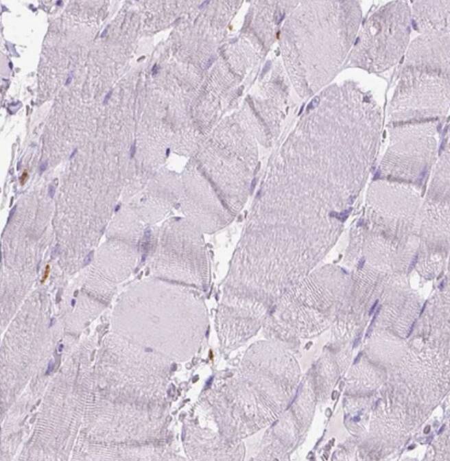  Staining of human skeletal muscle shows no positivity in myocytes as expected.
